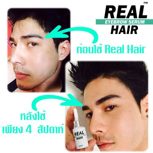 Real Hair ยาปลูกผม เซรั่มปลูกคิ้ว ปลูกหนวด ปลูกคิ้วหนา ปลูกขนตา ปลูกจอน ปลูกเครา