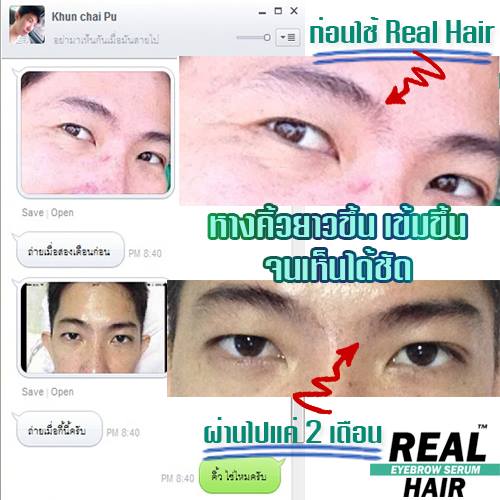 Real Hair ยาปลูกผม เซรั่มปลูกคิ้ว ปลูกหนวด ปลูกคิ้วหนา ปลูกขนตา ปลูกจอน ปลูกเครา