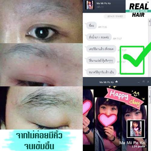 Real Hair ยาปลูกผม เซรั่มปลูกคิ้ว ปลูกหนวด ปลูกคิ้วหนา ปลูกขนตา ปลูกจอน ปลูกเครา