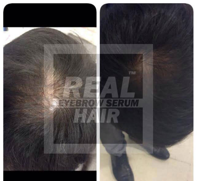 Real Hair ยาปลูกผม เซรั่มปลูกคิ้ว ปลูกหนวด ปลูกคิ้วหนา ปลูกขนตา ปลูกจอน ปลูกเครา