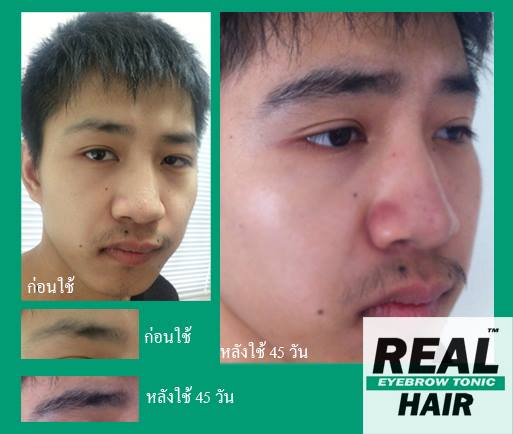 Real Hair ยาปลูกผม เซรั่มปลูกคิ้ว ปลูกหนวด ปลูกคิ้วหนา ปลูกขนตา ปลูกจอน ปลูกเครา