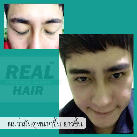 Real Hair ยาปลูกผม เซรั่มปลูกคิ้ว ปลูกหนวด ปลูกคิ้วหนา ปลูกขนตา ปลูกจอน ปลูกเครา